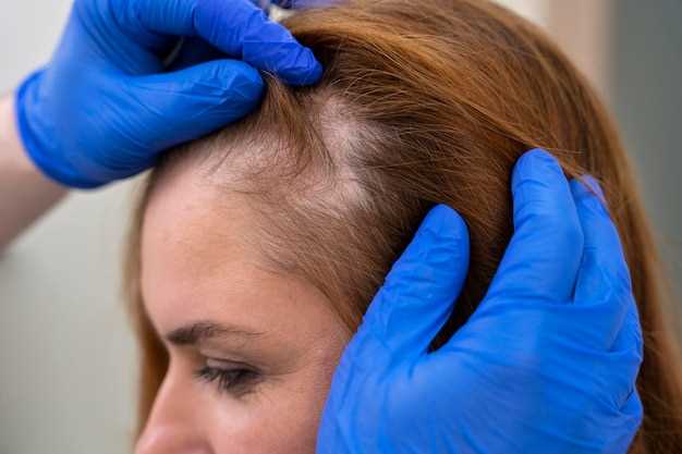 How to Promote Hair Growth with Amlodipine