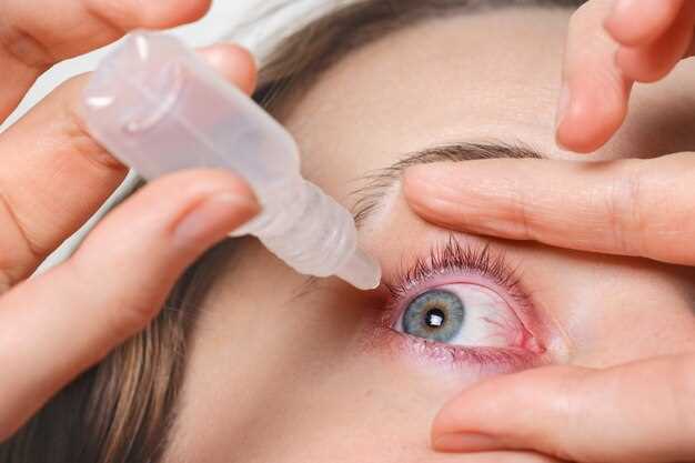 Other possible causes of watery eyes
