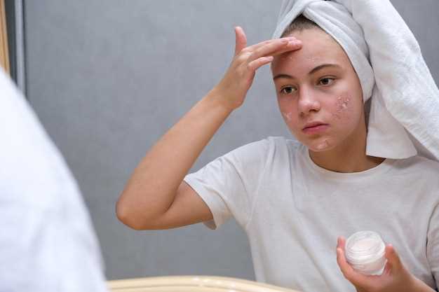 Managing acne while taking amlodipine
