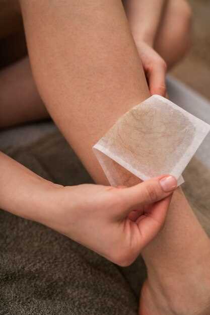 Amlodipine transdermal patch