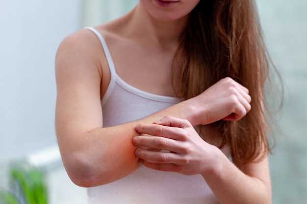 Does amlodipine cause skin rash