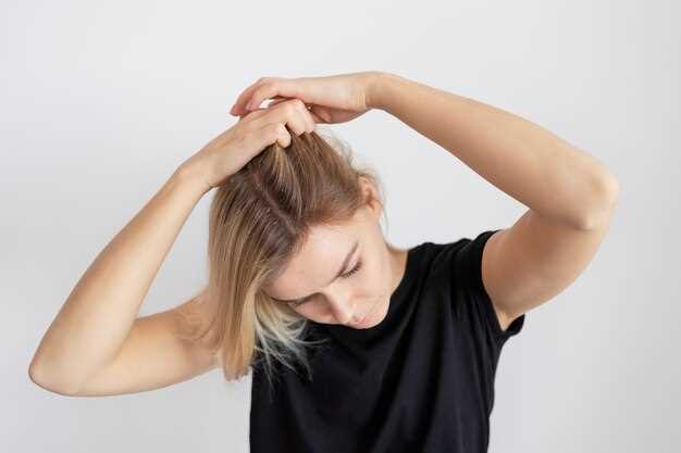 Hair loss from amlodipine