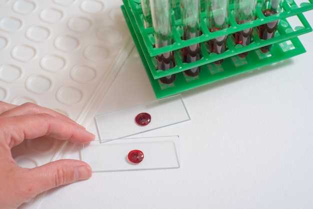 Off label use of amlodipine